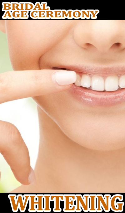 歯のホワイトニング